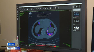 В Якутской городской больнице активно внедряют технологии с использованием искусственного интеллекта