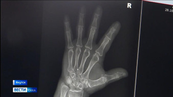 Новый подход к диагностике. Травматологическое отделение РБ №2 оснастили современным рентген-комплексом