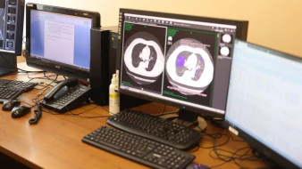 ИИ на службе. В Якутии свыше 67 тысяч лучевых исследований обработано сервисом искусственного интеллекта