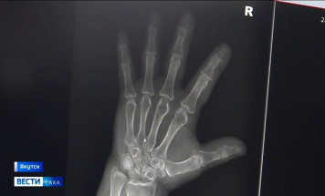 Новый подход к диагностике. Травматологическое отделение РБ №2 оснастили современным рентген-комплексом